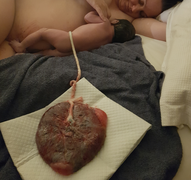 Clamping and Cutting the Umbilical Cord
